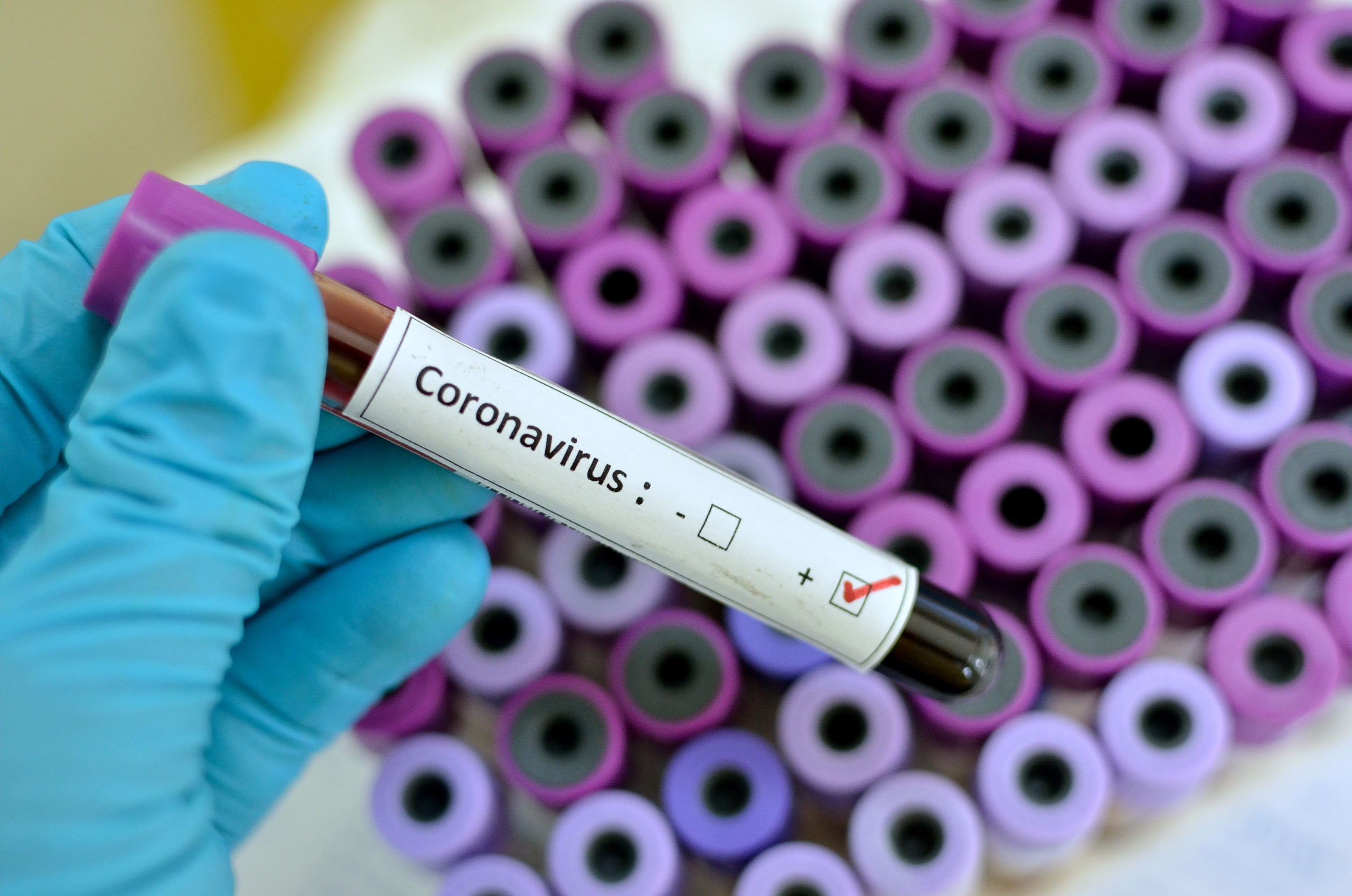Coronavirus a Reggio Calabria