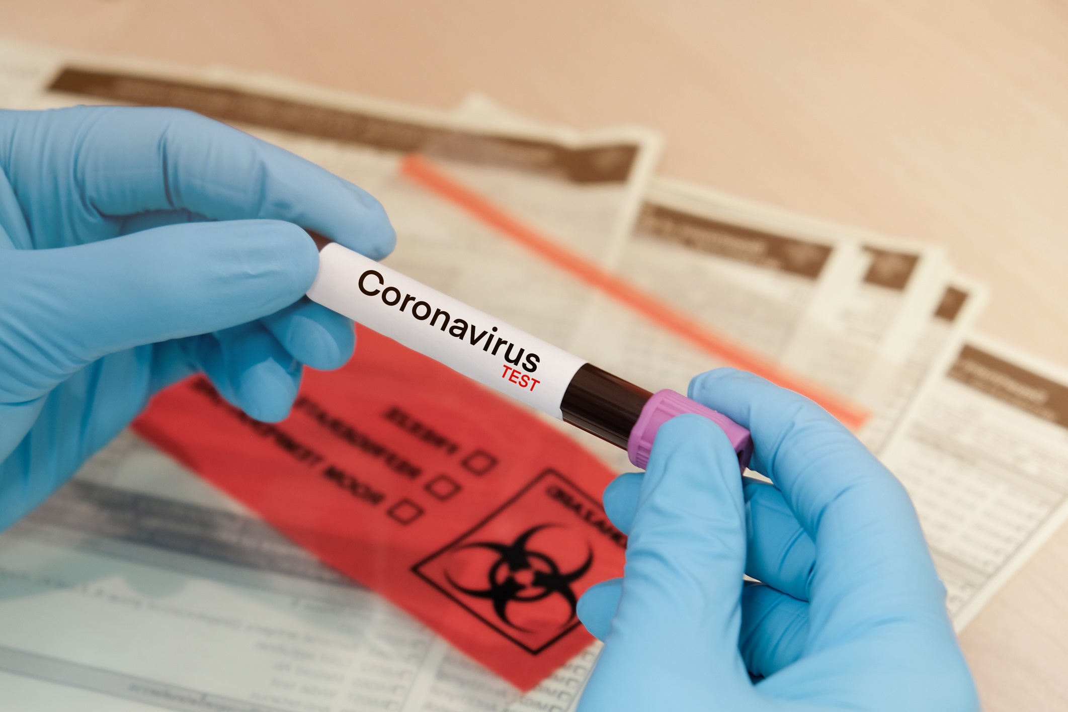 vittima Coronavirus a Cosenza