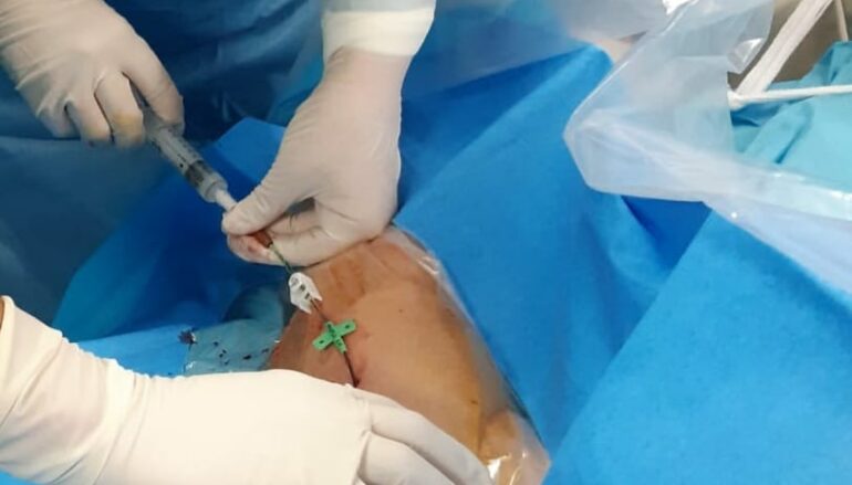Ospedale Lamezia: attivato ambulatorio impianti accessi venosi